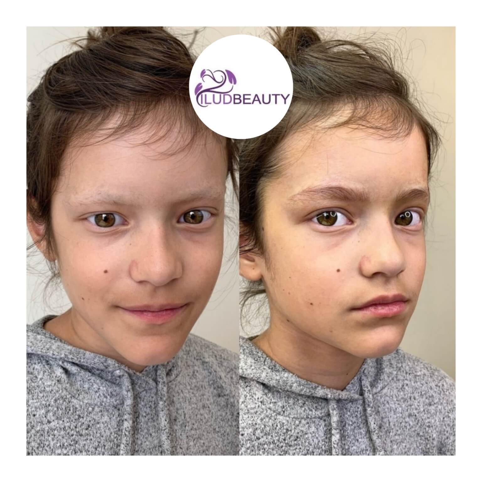 microblading client - young boy